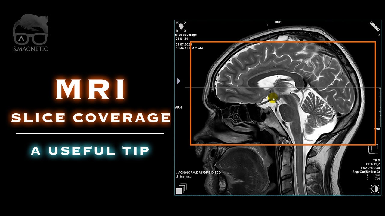 MRI – SLICE COVERAGE – A USEFUL TIP
