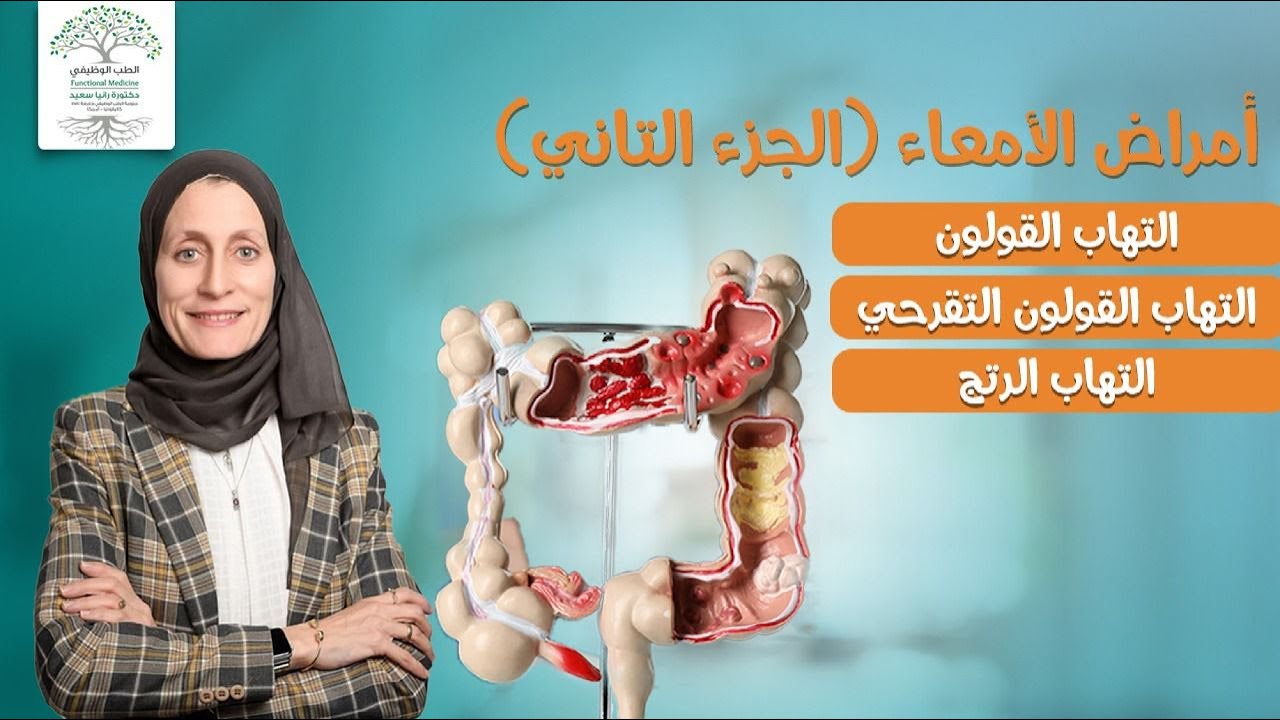 ودع التهاب القولون و الإمساك | أمراض الأمعاء الجزء الثاني