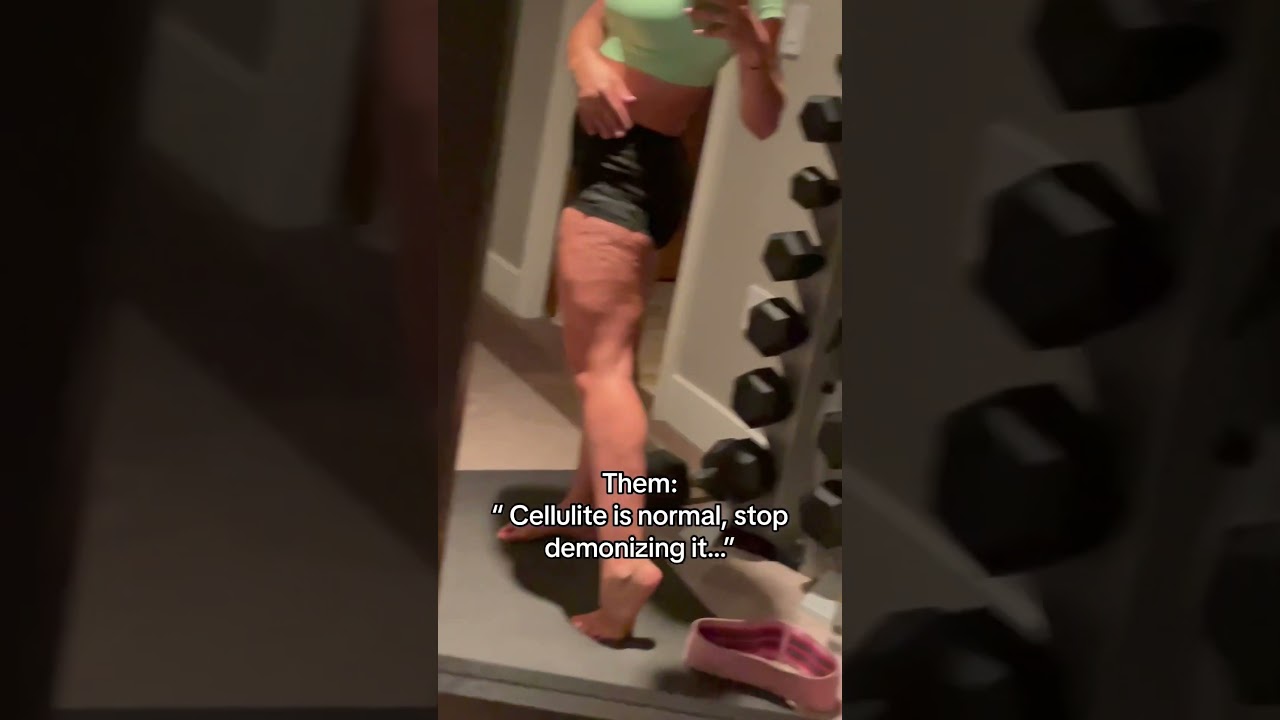 You can 100% reduce the look of cellulite #cellulite #fitnessmotivation #shorts