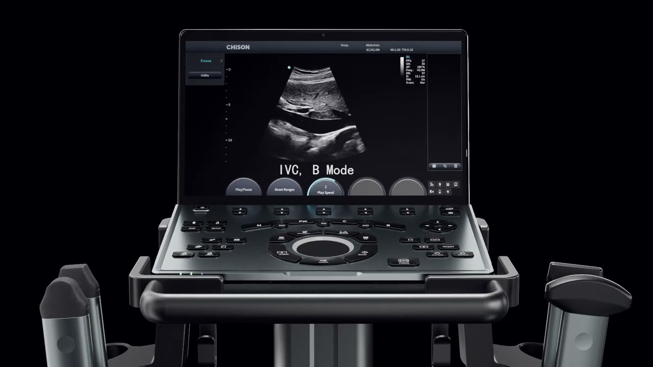 CHISON SonoAir: One Device, Endless Possibilities
