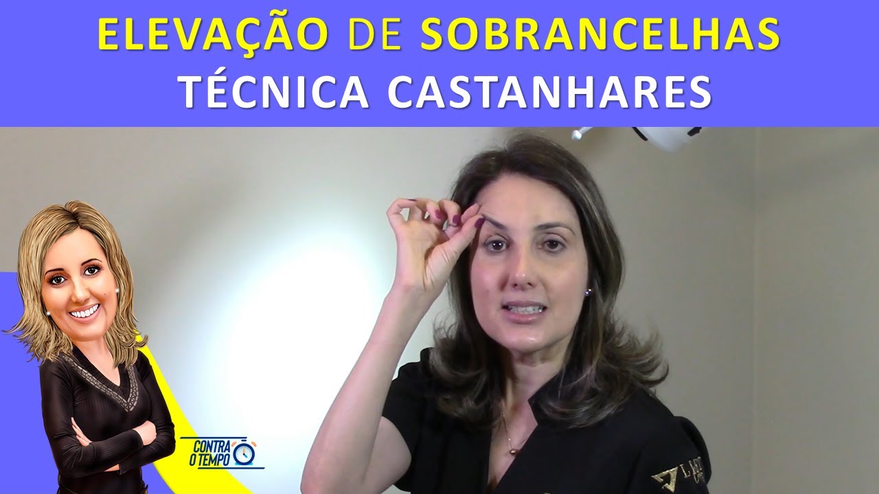 Elevação de sobrancelhas com cirurgia - Técnica Castanhares