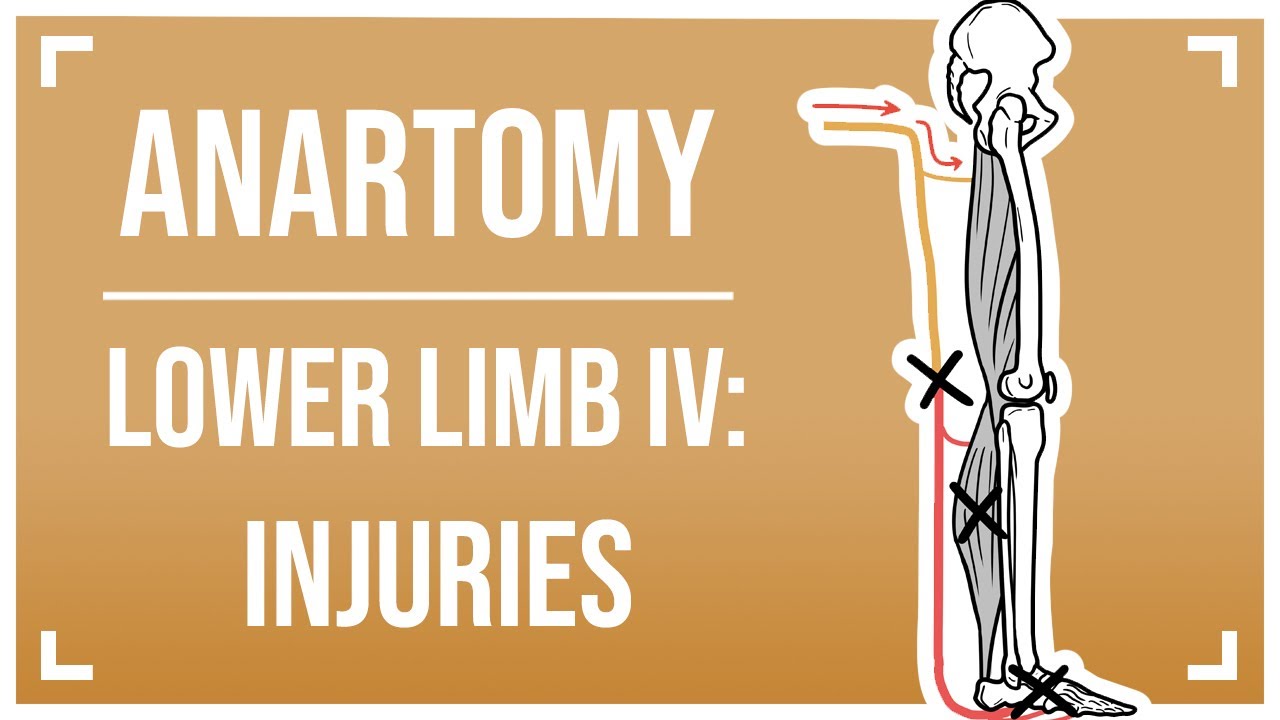 Nerves of the Lower Limb IV: Injuries