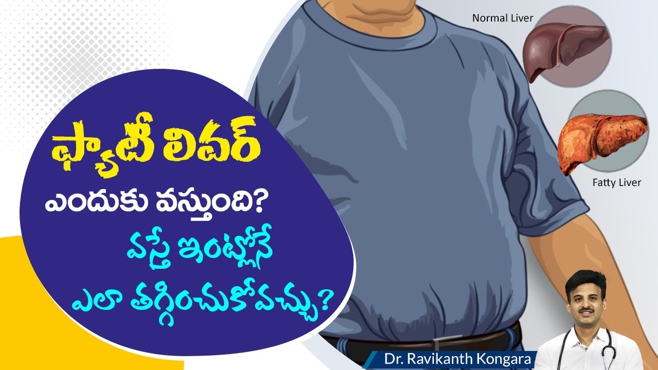 Causes of Fatty Liver | How to Treat Fatty Liver | Avoid Alcohol | Obesity | Dr.Ravikanth Kongara