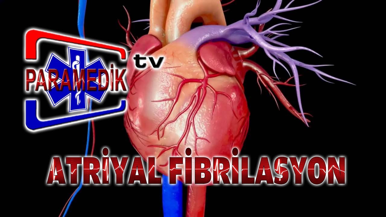 EKG - ATRİYAL ARİTMİLER - Atriyal Fibrilasyon
