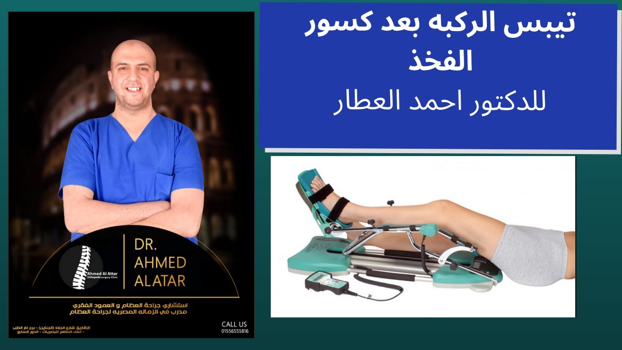 تيبس الركبه بعد كسور الفخذ للدكتور احمد العطار