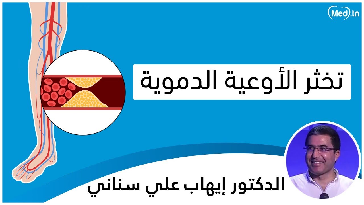 تخثر الأوعية الدموية  | الدكتور ايهاب علي سناني