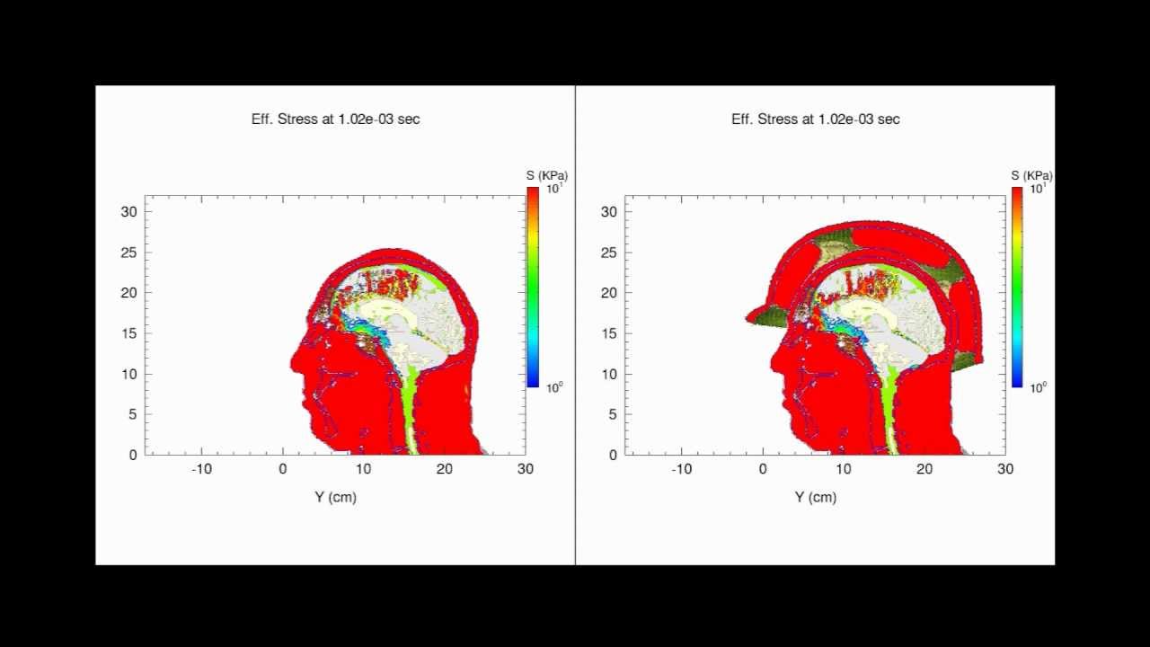 Traumatic Brain Injury