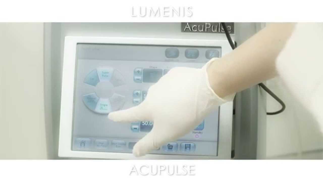 AcuPulse Laser Machine - Explainer Video | Lumenis