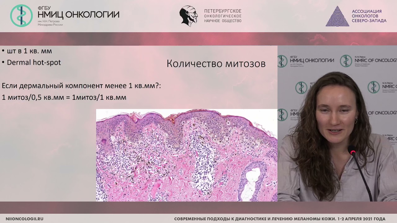 Меланоцитарные опухоли кожи: что должно быть отражено в морфологическом заключении? (Артемьева А.С.)