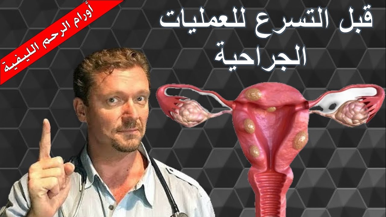 لتقليص أورام الرحم الليفية (اللحمية)