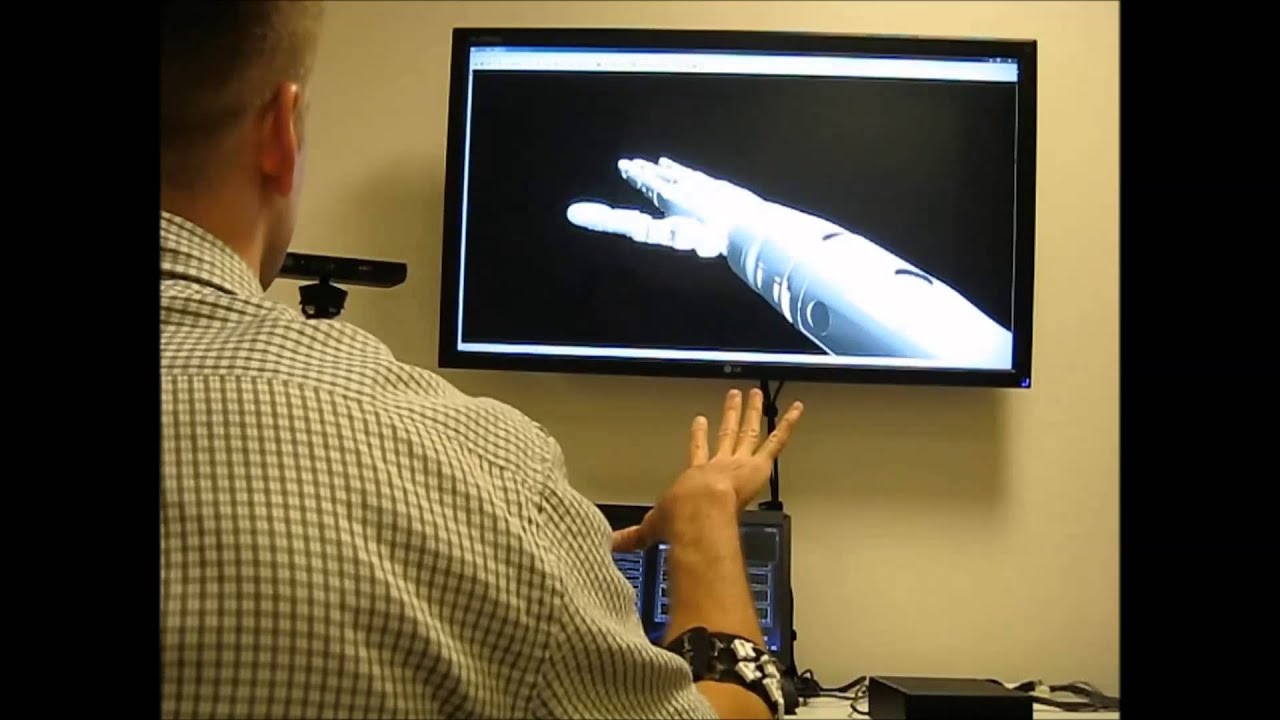 An EMG-based prosthesis control experiment