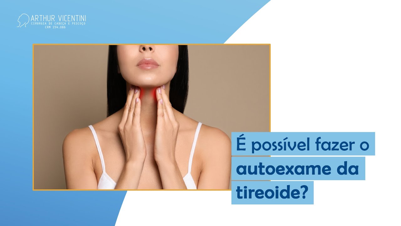 É possível fazer o autoexame da tireoide? | Dr. Arthur Vicentini CRM 154.086