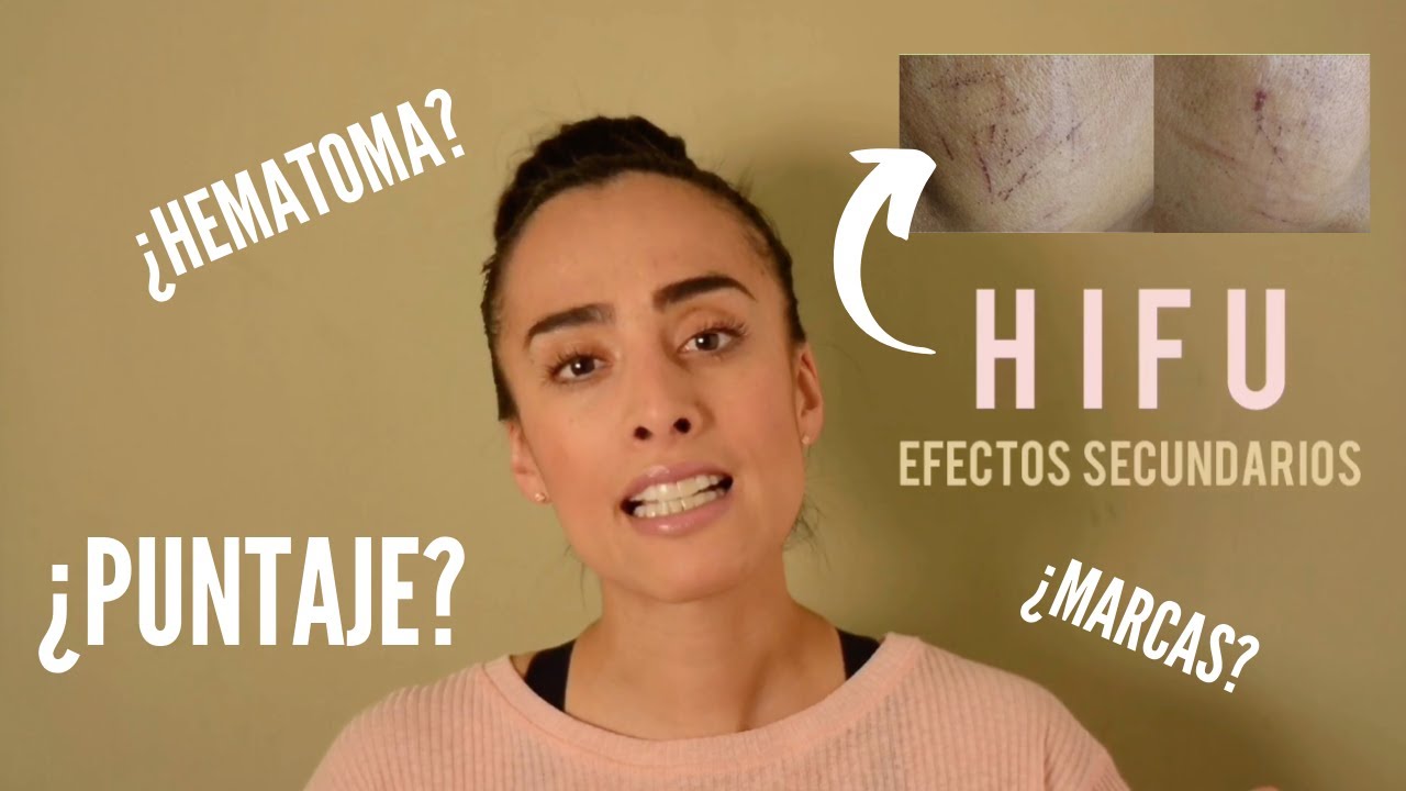 Contraindicaciones del HIFU FACIAL