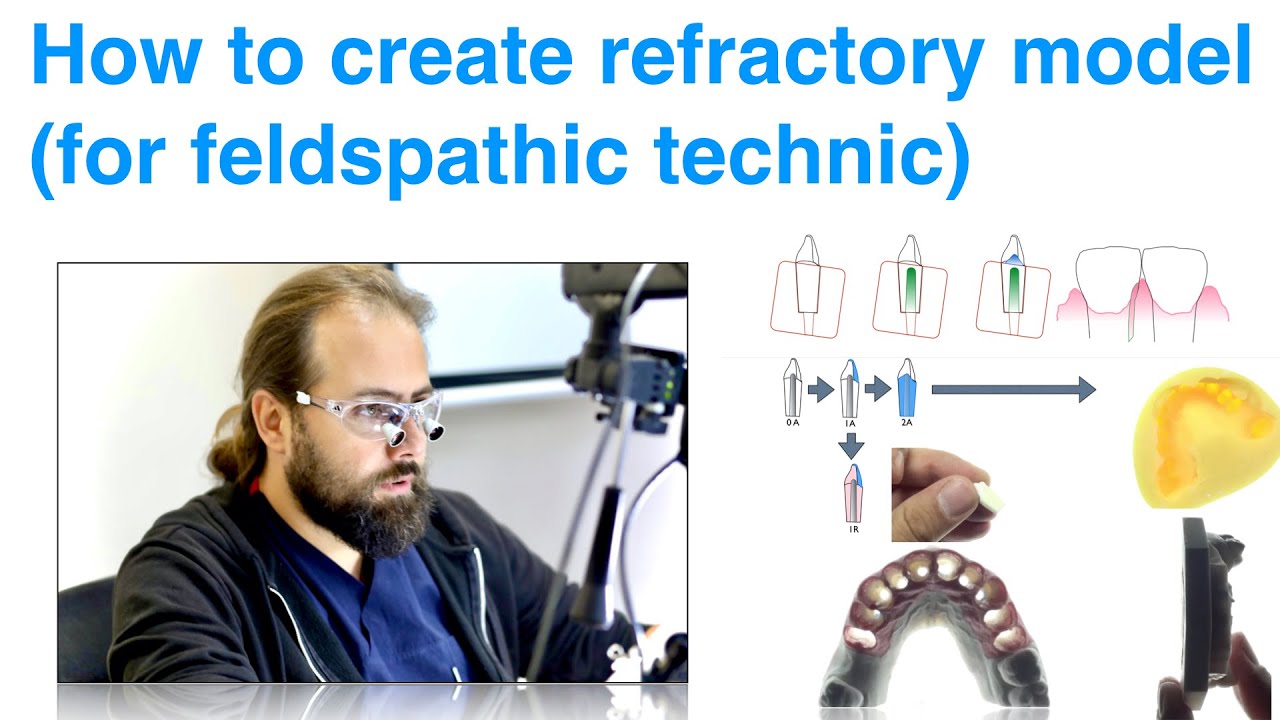 Alveolar refractory model creation (Inspired by Michel Magne)