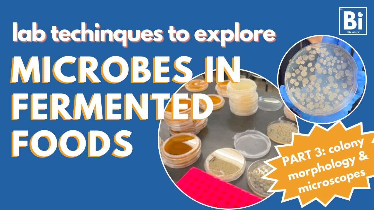 Lab Techniques to Explore Microbes in Fermented Products: Part 3 [Colony Morphology & Microscopy]