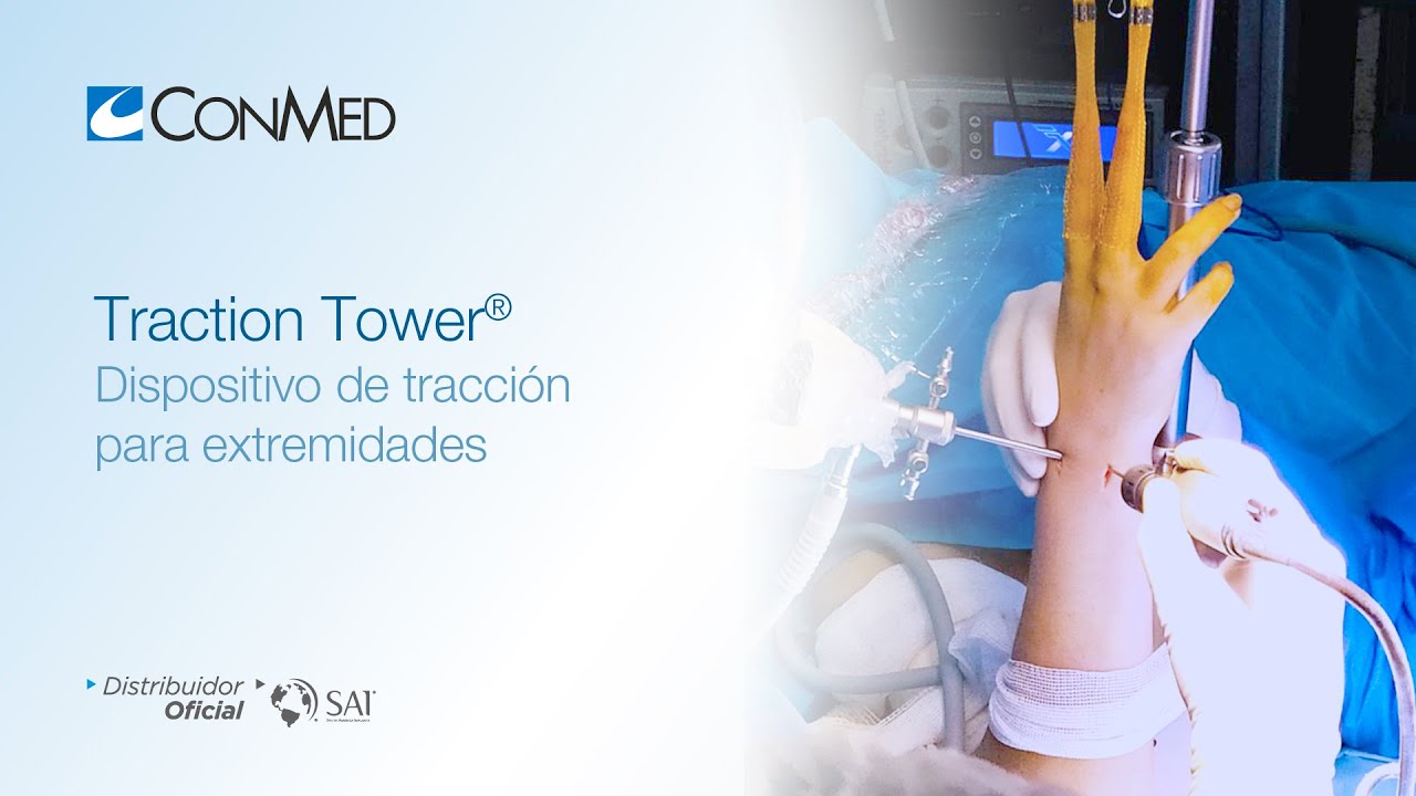 Traction Tower® Dispositivo de tracción para Extremidades | CONMED Product
