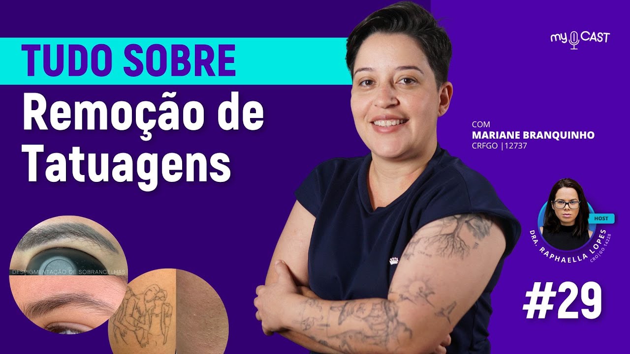 REMOÇÃO de Tatuagens  TUDO que voce precisa saber | myCast 29