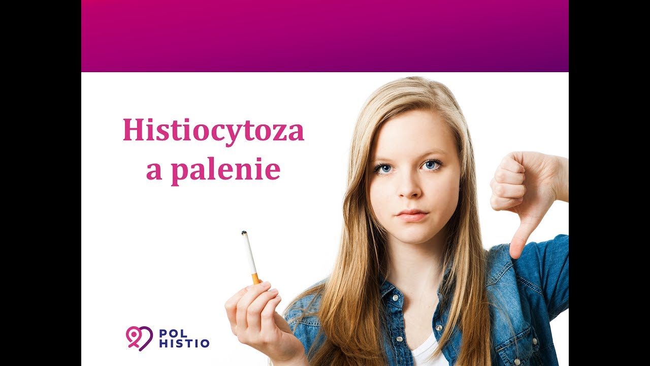 Histiocytoza vs  palenie