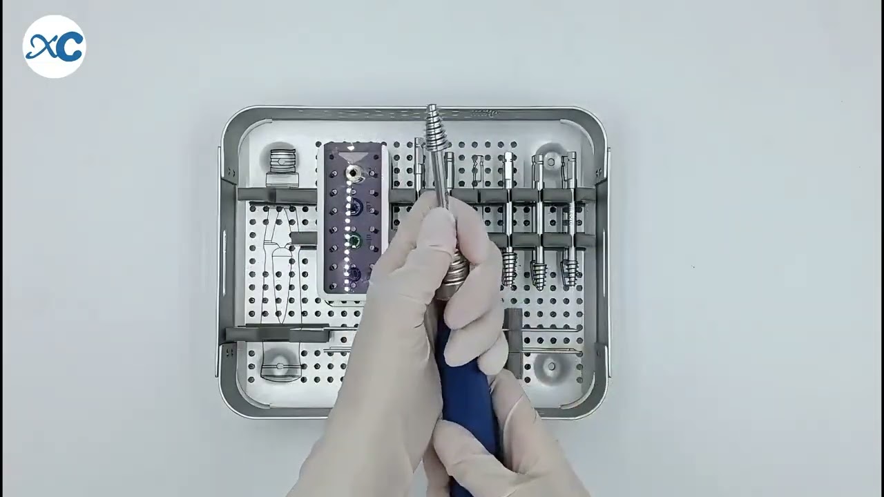 Subtalar Arthroereisis Screw System Demo: Minimally Invasive Flatfoot Correction | XC Medico