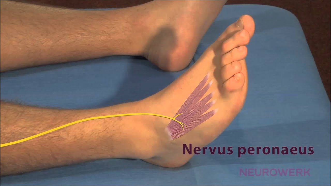 Motorische Neurographie - Peronaeus