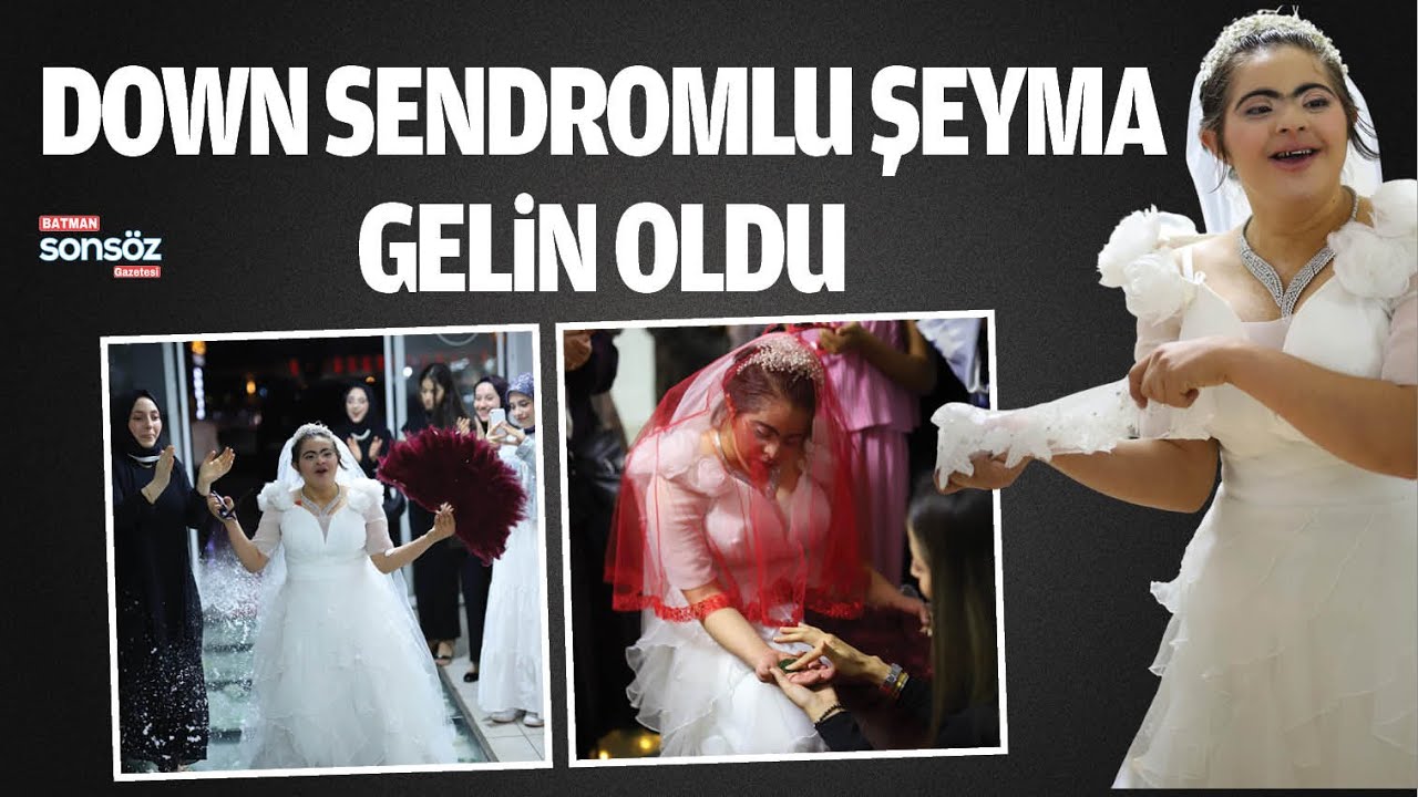 Down sendromlu Şeyma, gelin oldu