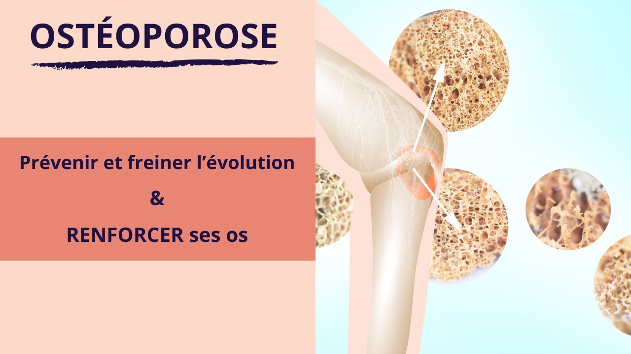 OSTEOPOROSE : exercices pour prévenir et freiner l'évolution
