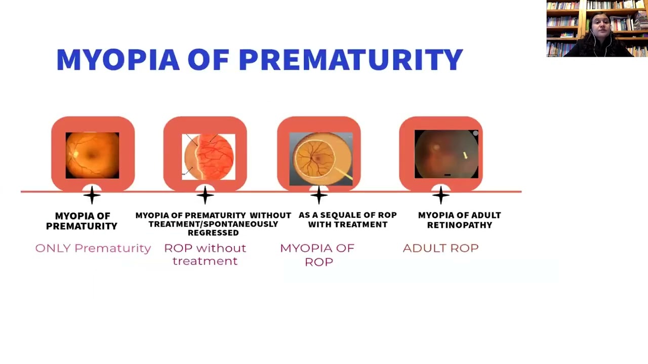 Lecture: Myopia in Children Treated for Retinopathy of Prematurity