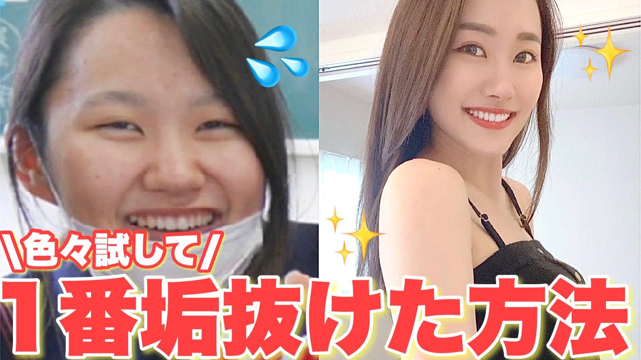 【必見】色々試してコレが1番垢抜けた！今すぐ変われる方法５選！