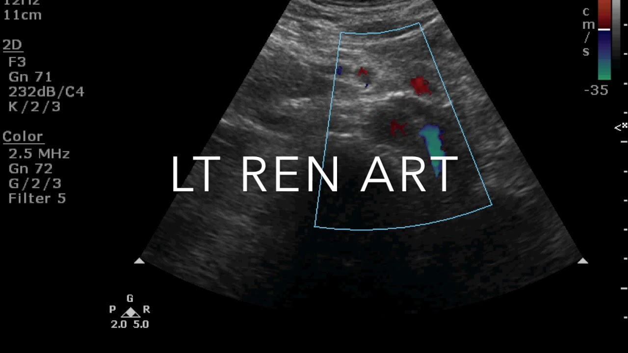TMT: RENAL DOPPLER PART I