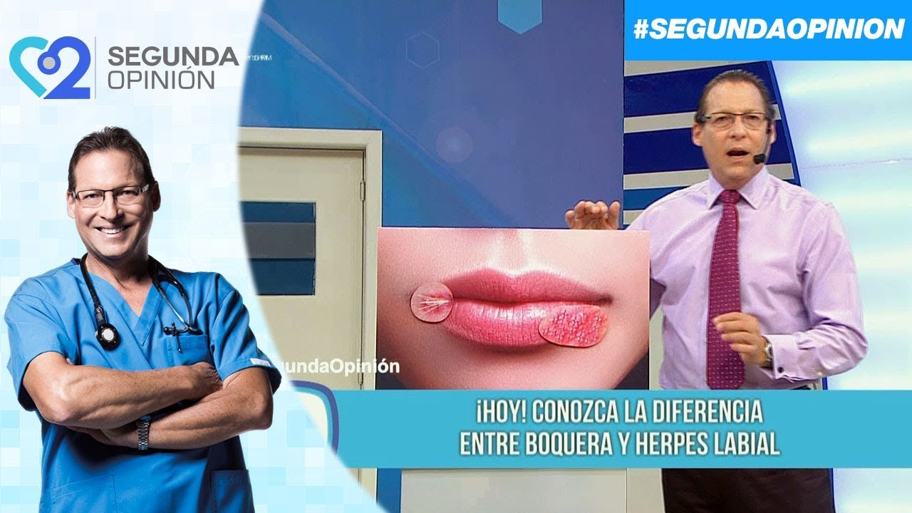 ¿Cuál es la diferencia entre el herpes y la boquera?