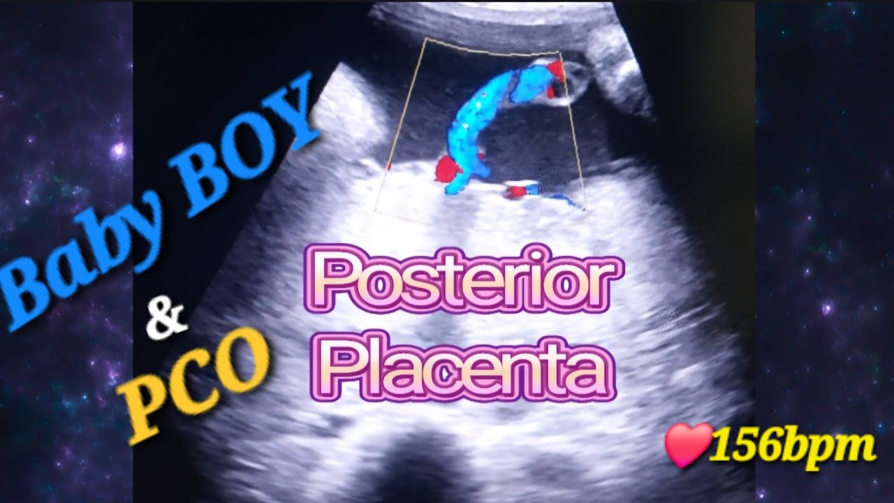 Genderreveal with Baby Movements Why & When | Posterior Placenta with baby💙 | PCO | Polycystic ovary
