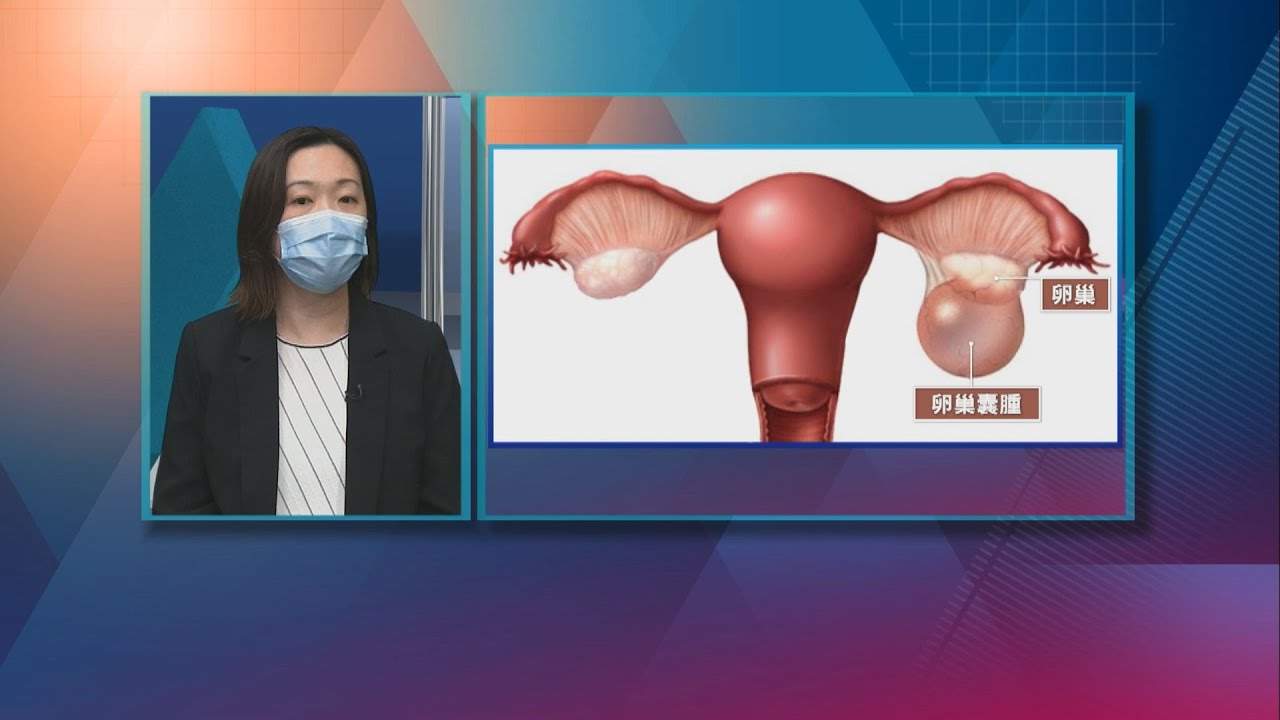 20210222【杏林在線】甚麼是卵巢囊腫？