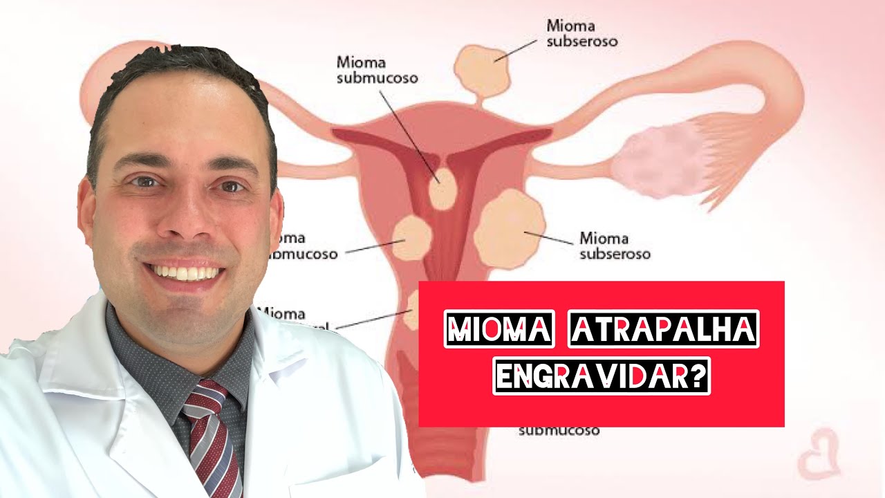 Mioma atrapalha engravidar? Existe remédio para mioma?