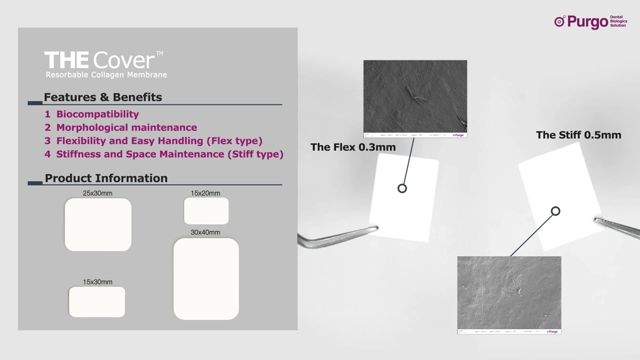[Hands on] The Cover™ Flex / Stiff Resorbable Collagen Membrane