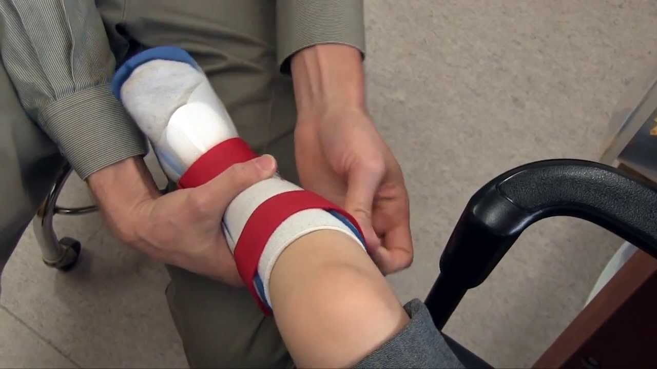 Patient story | 4-year-old boy with excess plantarflexion | Tami2 | Cascade Dafo