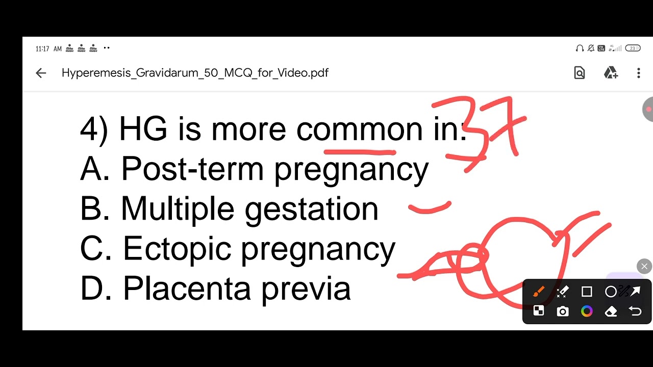 Hyperemesis gravidarum MCQ, compitition exam ,norcet bsc(N) semester exam, obg high risk pregnancy