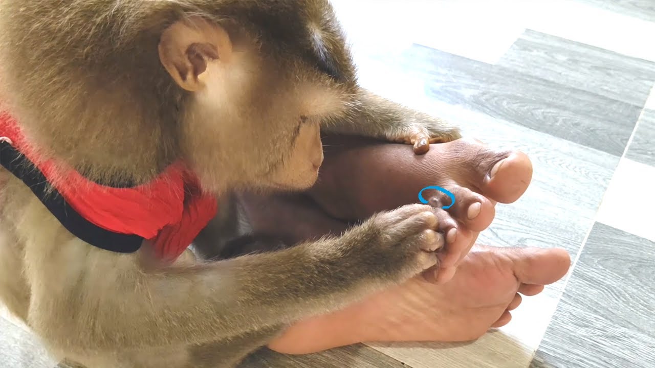 Dr LYLY Found New Type Of Deed Cell Located In The Toes Removed To Support Tissue Regeneration