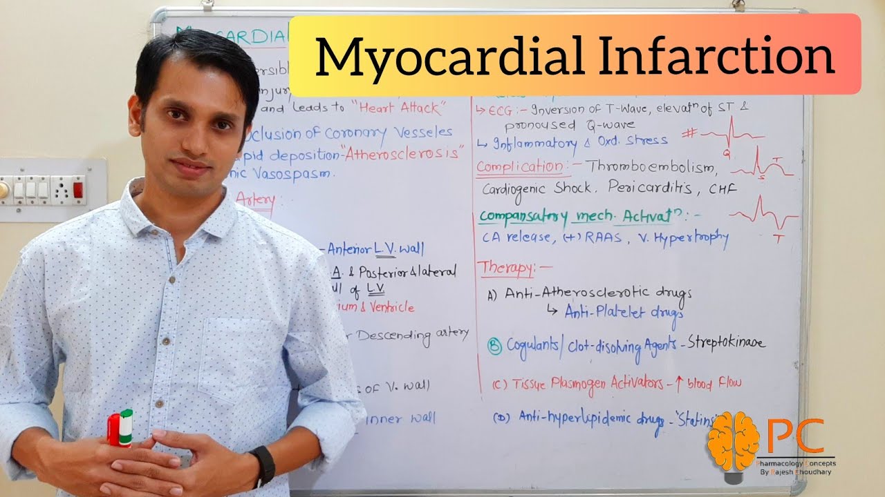 Myocardial Infarction: Bssic Introduction and Therapy | Ischemic Heart Disease |
