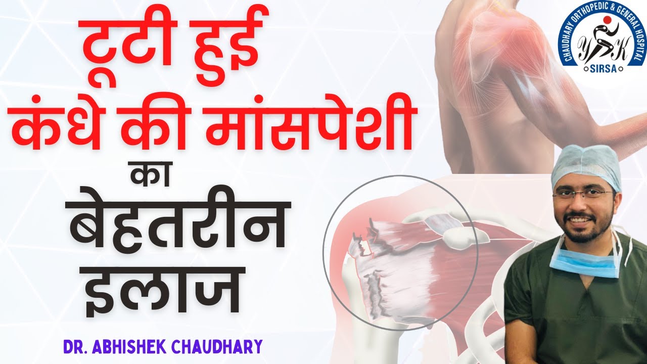 टूटी हुई कंधे की मांसपेशी का बेहतरीन इलाज, Rotator Cuff, Supraspinatus Tear Treatment in Sirsa