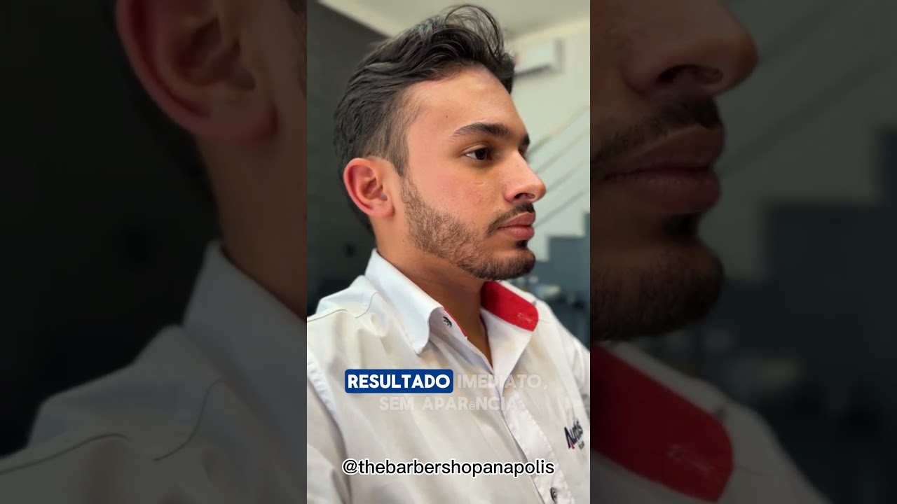 Preenchimento de barba 64999414284
