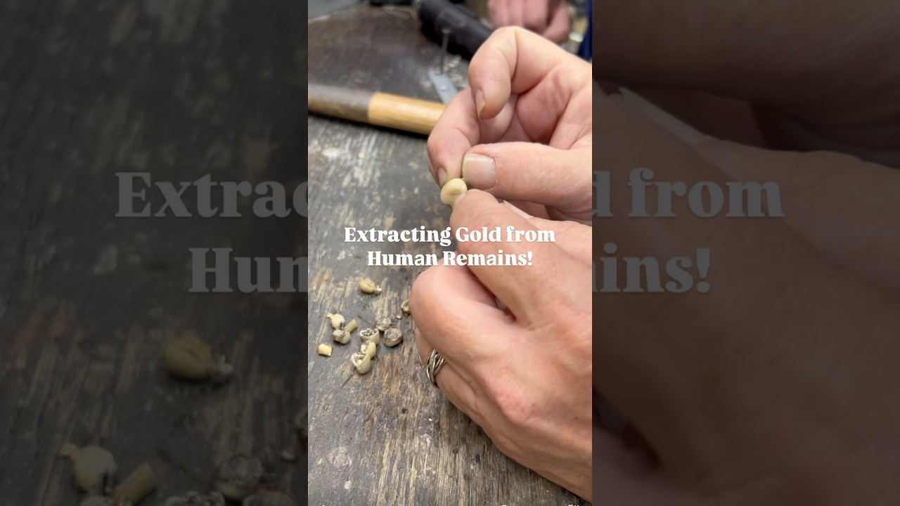 Gold Teeth: Hidden Treasure Inside! #goldteeth #gold