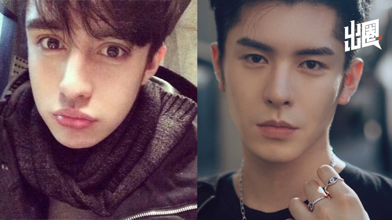 【出圈】林皓洋：一个男演员整容的十年 Lin Haoyang: An Actor Who Has Experienced Plastic Surgery for Ten Years