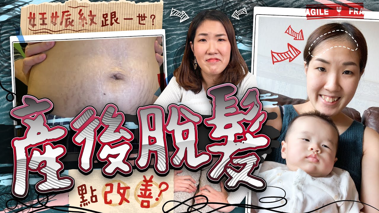 【產後脫髮洗頭水係救星？】不敢見人😭妊娠紋消除到？母乳媽媽幾時嚟M🩸惡露多久排乾淨？小心產後抑鬱　媽媽心靈要強大💪🏻❤️　懷孕｜頭皮問題｜改善脫髮｜產後FAQ｜《跟住小編做媽咪》