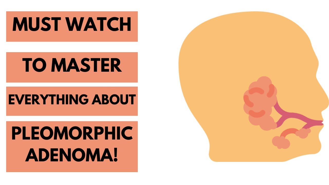 Mastering Pleomorphic Adenoma: A Must-Watch for Dentists and Dental Students