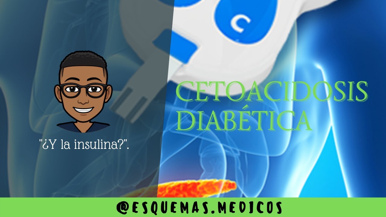 CETOACIDOSIS DIAB&Eacute;TICA / CONCEPTOS B&Aacute;SICOS.