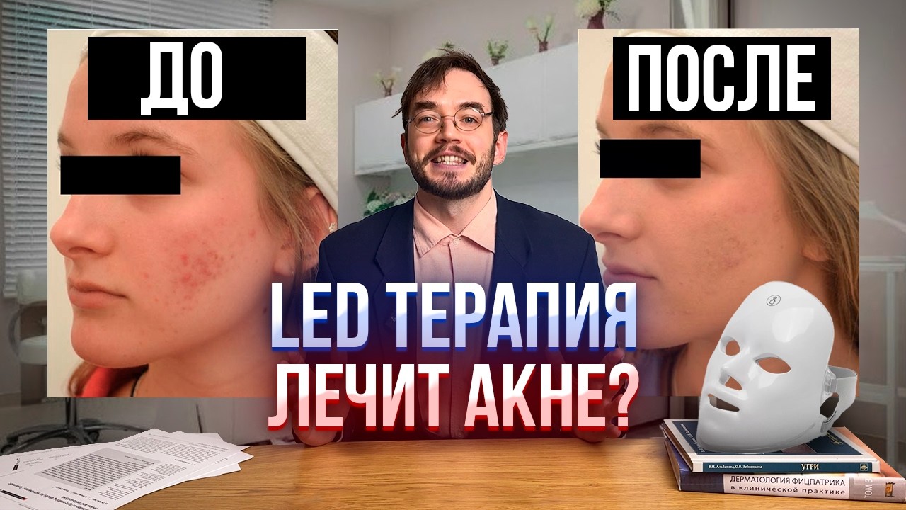 LED терапия лечит Акне? Учёный-биолог разбирает исследования по косметологии