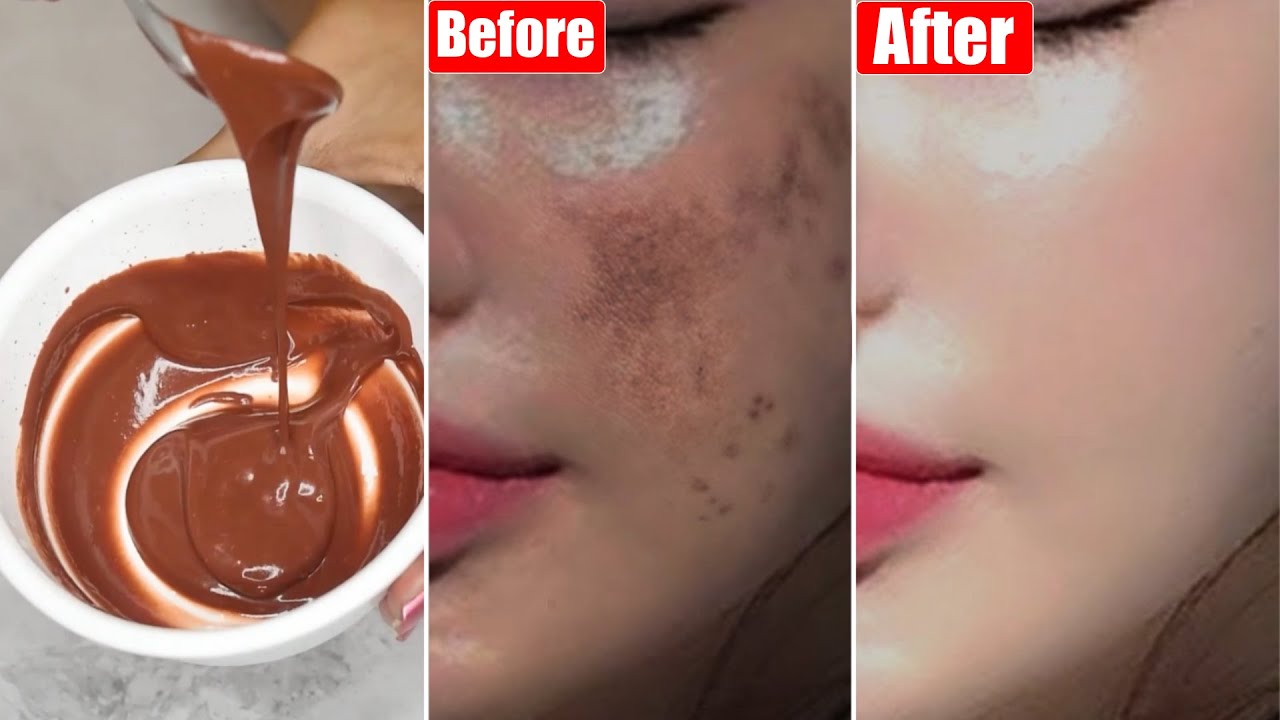 This👆🏼Face Pack Brightens Skin Tone, Reduce Pigmentation & Spots-Gives Pink Glowing Skin in 3 Days