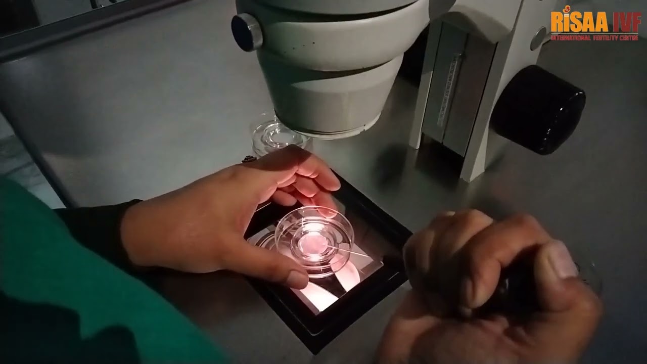 Denudation process