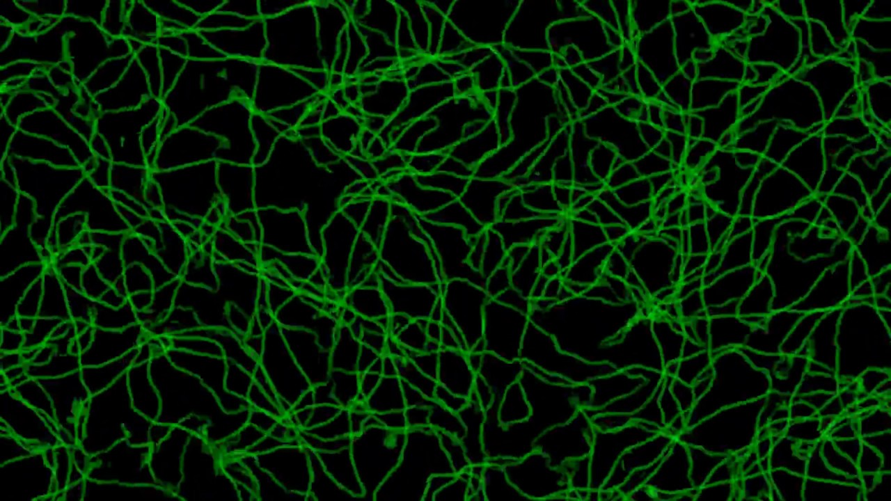 Cosmic strings in the Abelian Higgs model