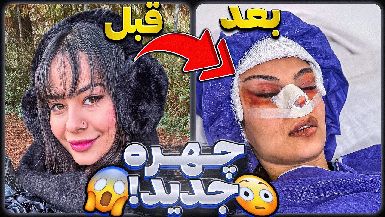بالاخره جراحی کردم🩸😰